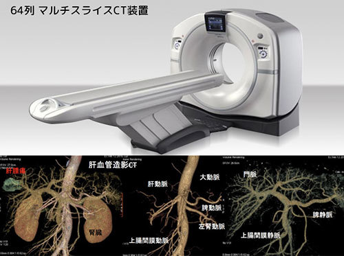64列マルチスライスCT装置